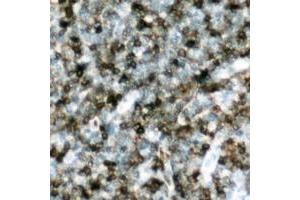 Immunohistochemical analysis of p47 phox (pS328) staining in human lymph node formalin fixed paraffin embedded tissue section.