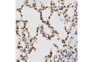Immunohistochemistry of paraffin-embedded rat lung using TriMethyl-Histone H3-K9 antibody. (Histone 3 anticorps  (H3K9me3))