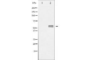 Western blot analysis of Lyn phosphorylation expression in H2O2 treated K562 whole cell lysates,The lane on the left is treated with the antigen-specific peptide. (LYN anticorps  (pTyr507))
