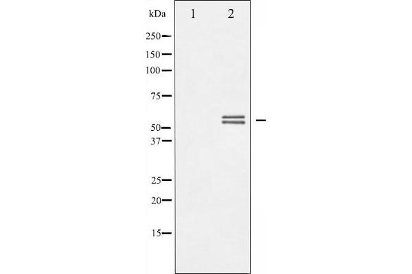LYN Antikörper  (pTyr507)