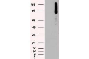 Image no. 4 for anti-B-Raf proto-oncogene, serine/threonine kinase (BRAF) antibody (ABIN1496951)