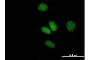 Immunofluorescence of purified MaxPab antibody to ATF2 on HeLa cell.