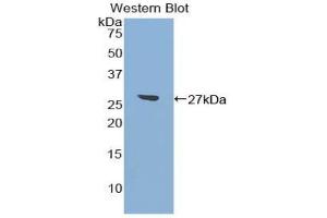 Detection of Recombinant ATF7, Mouse using Polyclonal Antibody to Activating Transcription Factor 7 (ATF7) (AFT7 anticorps  (AA 50-270))
