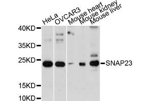 Western blot analysis of extracts of various cell lines, using SNAP23 antibody. (SNAP23 anticorps)