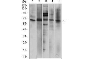 Western blot analysis using P2RX7 mouse mAb against A431 (1), U251 (2), Hela (3), U937 (4), and HepG2 (5) cell lysate.
