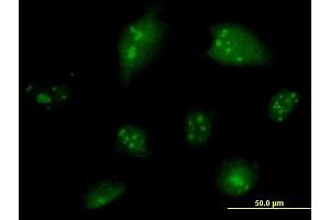 Immunofluorescence of monoclonal antibody to NCOA6 on HeLa cell. (NCOA6 anticorps  (AA 1954-2063))