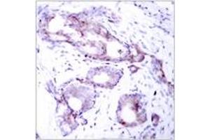 Immunohistochemistry (IHC) image for anti-Myc Proto-Oncogene protein (MYC) (pSer373) antibody (ABIN2888476) (c-MYC anticorps  (pSer373))