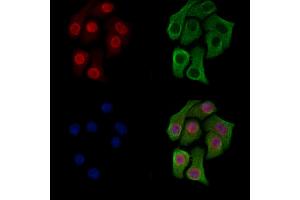 ABIN6266225 and ABIN6277496 staining Hela cells(heat shock treatment) by IF/ICC.