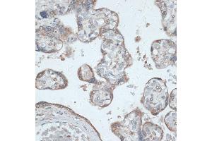 Immunohistochemistry of paraffin-embedded human placenta using PMEP antibody (6555) at dilution of 1:100 (40x lens). (PMEPA1 anticorps  (AA 173-252))