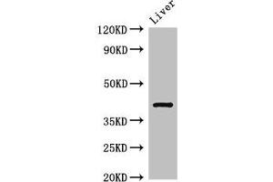 Western Blot Positive WB detected in: Rat liver tissue All lanes: TGDS antibody at 3 μg/mL Secondary Goat polyclonal to rabbit IgG at 1/50000 dilution Predicted band size: 41 kDa Observed band size: 41 kDa (TGDS anticorps  (AA 143-305))