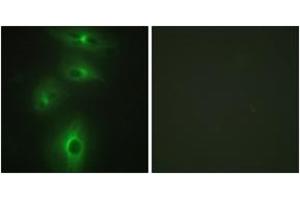 Immunofluorescence analysis of HeLa cells, using TMPRSS3 Antibody. (TMPRSS3 anticorps  (AA 405-454))