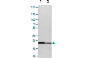 Western blot analysis of cell lysates with SPCS2 polyclonal antibody  at 1:250-1:500 dilution. (SPCS2 anticorps)