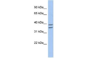 WB Suggested Anti-ZADH2 Antibody Titration: 0. (ZADH2 anticorps  (N-Term))