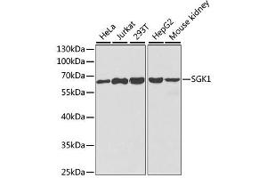 Western blot analysis of extracts of various cell lines, using SGK1 antibody. (SGK1 anticorps  (AA 172-431))