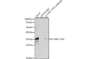 Immunoprecipitation analysis of 200 μg extracts of HeLa cells, using 3 μg Phospho-CDK1-T161 pAb (ABIN3020135, ABIN3020136, ABIN3020137, ABIN1681454 and ABIN6225511).