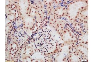 Formalin-fixed and paraffin embedded rat kidney labeled with Rabbit Anti-CDKN1A (Ser130) Polyclonal Antibody, Unconjugated  at 1:200 followed by conjugation to the secondary antibody and DAB staining
