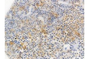 ABIN6256336 and ABIN6267426 at 1/100 staining human pituitary adenoma by IHC-P.