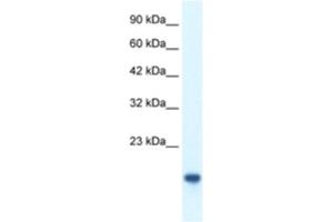 Western Blotting (WB) image for anti-C-Myc Binding Protein (MYCBP) antibody (ABIN2460299) (MYCBP anticorps)