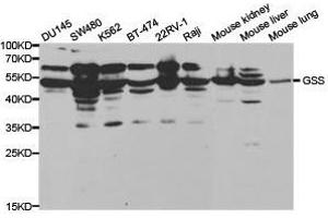 Western Blotting (WB) image for anti-Glutathione Synthetase (GSS) antibody (ABIN1872909)