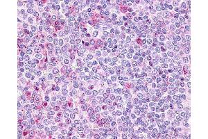 Staining of human spleen using ABIN121972