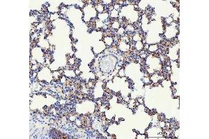 IHC analysis of VE Cadherin using anti-VE Cadherin antibody (ABIN5692987).