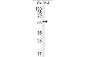 LOC129293 Antibody (C-term) (ABIN655687 and ABIN2845146) western blot analysis in SK-BR-3 cell line lysates (35 μg/lane). (TRABD2A anticorps  (C-Term))