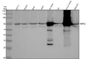 Western blot analysis of HSPA2 using anti-HSPA2 antibody (ABIN7605188).