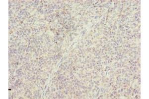 Immunohistochemistry of paraffin-embedded human tonsil tissue using ABIN7172965 at dilution of 1:100 (TMTC4 anticorps  (AA 245-376))