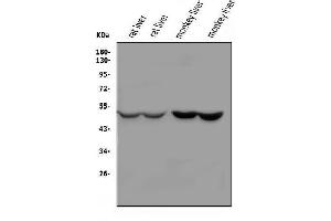 Western blot analysis of SERPINA4 using anti-SERPINA4 antibody (ABIN7600083).