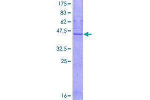 Image no. 1 for Sarcospan (Kras Oncogene-Associated Gene) (SSPN) (AA 1-217) protein (GST tag) (ABIN1321414)