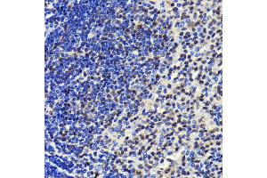 Immunohistochemistry of paraffin-embedded rat spleen using SP1 antibody (ABIN7270505) at dilution of 1:100 (40x lens).