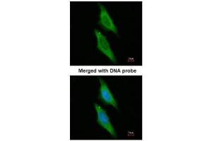 ICC/IF Image Immunofluorescence analysis of paraformaldehyde-fixed HeLa, using ARA9 , antibody at 1:200 dilution.