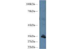 Western Blot; Sample: Human Liver lysate; Primary Ab: 1µg/ml Rabbit Anti-Human PPIE Antibody Second Ab: 0.