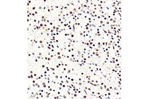 Immunohistochemistry of paraffin embedded rat embryonic rat using BRN3A (ABIN7075163) at dilution of 1:700 (400x lens) (POU4F1 anticorps)