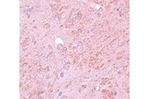 Immunohistochemistry (IHC) image for anti-Protein Inhibitor of Activated STAT, 4 (PIAS4) (N-Term) antibody (ABIN1031512) (PIAS4 anticorps  (N-Term))