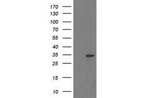 Western Blotting (WB) image for anti-Haloacid Dehalogenase-Like Hydrolase Domain Containing 2 (HDHD2) antibody (ABIN1498628) (HDHD2 anticorps)