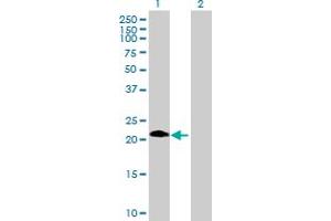 Western Blot analysis of ASB6 expression in transfected 293T cell line by ASB6 MaxPab polyclonal antibody. (ASB6 anticorps  (AA 1-197))