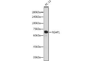 Western blot analysis of extracts of PC-12 cells, using RG antibody (ABIN7269819) at 1:1000 dilution. (RACGAP1 anticorps)