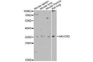 Western blot analysis of extracts of various cell lines, using HAVCR2 antibody. (TIM3 anticorps  (AA 22-202))