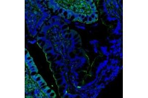 IF analysis of Villin using anti-Villin antibody (ABIN3042343). (Villin 1 anticorps  (C-Term))