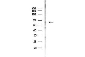 anti-CCR4-NOT Transcription Complex, Subunit 6 (CNOT6) (C-Term) antibody