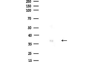 anti-Heterogeneous Nuclear Ribonucleoprotein D-Like (HNRPDL) (C-Term) antibody