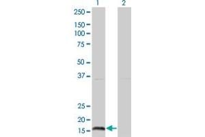 Western Blot analysis of IFNA2 expression in transfected 293T cell line by IFNA2 monoclonal antibody (M37), clone 2D6. (IFNA2 anticorps  (AA 24-188))