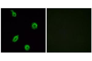 Immunofluorescence analysis of HUVEC cells, using HTR5B antibody. (HTR5B anticorps  (C-Term))