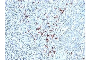 Formalin-fixed, paraffin-embedded human Tonsil stained with Kappa Light Chain Mouse Monoclonal Antibody (KLC264). (IGKC anticorps)