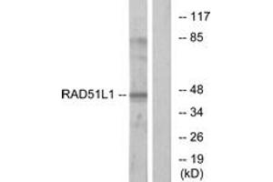 Western blot analysis of extracts from COS7 cells, using RAD51L1 Antibody. (RAD51 Homolog B anticorps  (AA 201-250))