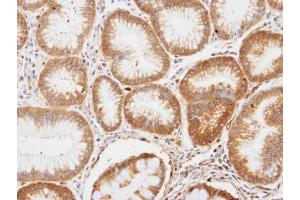 IHC-P Image Immunohistochemical analysis of paraffin-embedded human gastric tissue, using ENO1, antibody at 1:100 dilution.