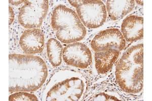 IHC-P Image Immunohistochemical analysis of paraffin-embedded human gastric tissue, using ENO1, antibody at 1:100 dilution. (ENO1 anticorps)