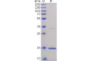Human TNFα Protein, His Tag on SDS-PAGE under reducing condition.