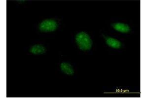 Immunofluorescence of purified MaxPab antibody to ARL3 on HeLa cell.